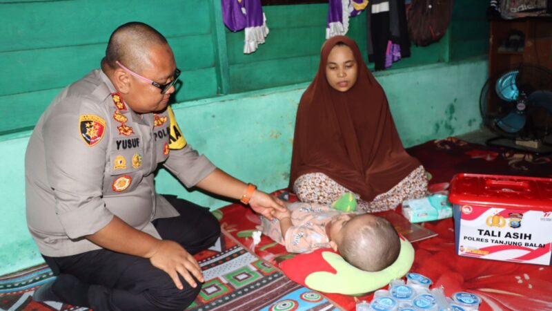 Kapolres Tanjungbalai Berikan Bantuan Tali Asih kepada Balita yang Menderita Penyakit Hidrosefalus Spina Bifida