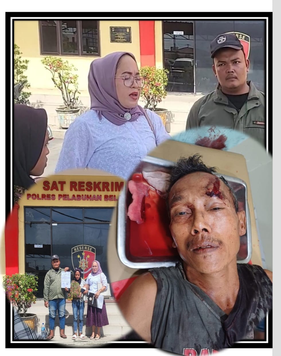 Kasus Pembacokan Diam Ditempat, Polsek Medan Labuhan Polres Pelabuhan Belawan Terkesan Abaikan Atensi Majelis Hakim