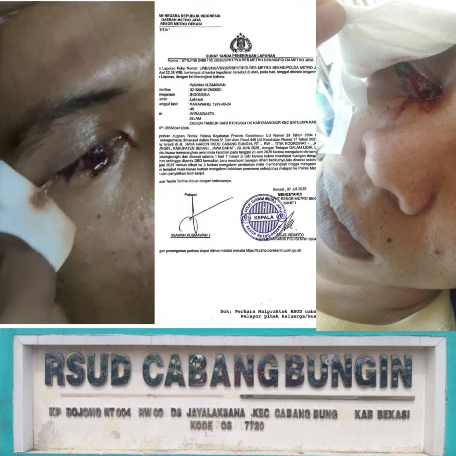 Merasa Jadi Korban Malpraktik Oleh Oknum Dokter RSUD Cabangbungin, Keluarga Korban Minta Keadilan Hukum ke Polres Metro Bekasi