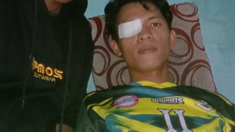 Bang Mulis Media Kunjungi Bayu Fadilah, Korban Dugaan Malpraktik RSUD Cabangbungin Bekasi 