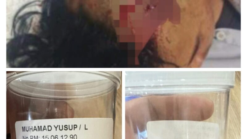 Aktivis dari Yayasan YAPERMA,Desak Pihak Kepolisian Segera Tangkap Pelaku Pembacokan Pelajar SMK Angkasa 1 Sepatan 