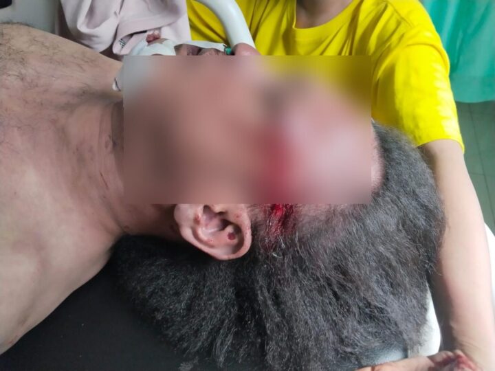 Diduga Dibunuh,LBH Medan Desak Poldasu Usut Tuntas Kematian Jurnalis Nico Saragih