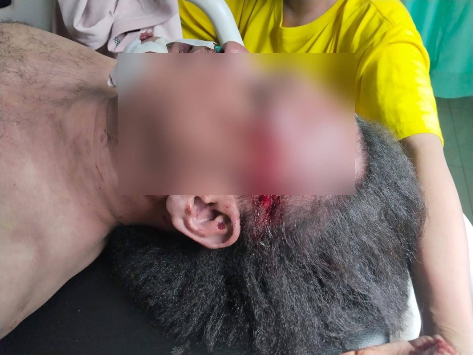 Diduga Dibunuh,LBH Medan Desak Poldasu Usut Tuntas Kematian Jurnalis Nico Saragih