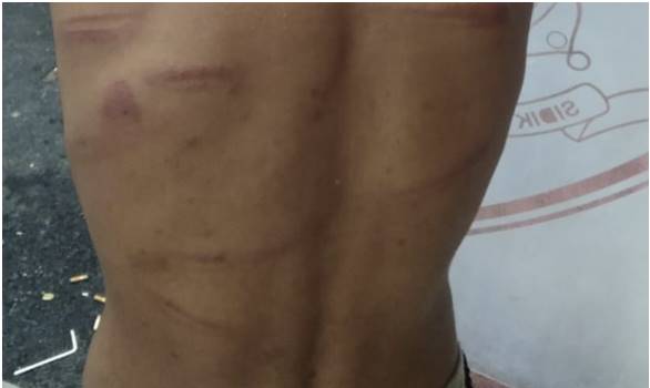 Pelaku Penganiayaan Terhadap Dua Bocah di Kawasan Sei Rotan Percut Bebas Berkeliaran 